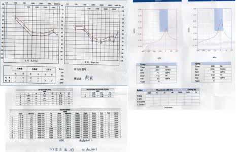 靶向治疗是什么意思 神经性耳聋是什么 怎样治疗神经性耳聋