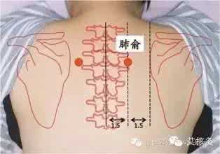 过敏性鼻炎咳嗽有痰 【肺俞穴】防过敏性鼻炎，止痰有奇效