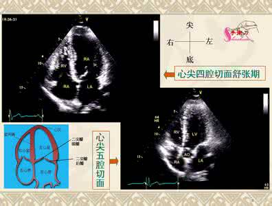 美式整脊手法视频教程 美式整脊手法操作图解 超声心动图操作手法图解