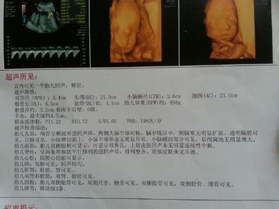 四维彩超怎么看性别 四维彩超怎么看性别 四维时医生说性别和爸爸一样 我的反应让老公笑了