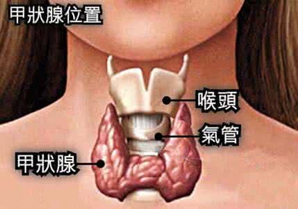 甲状腺良性肿瘤治疗 甲状腺良性肿瘤 中医治甲状腺良性肿瘤