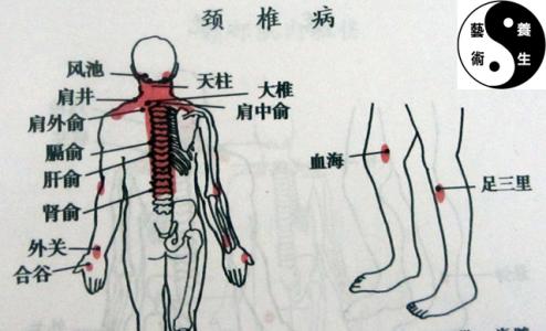 太阳病 颈椎病就是太阳病