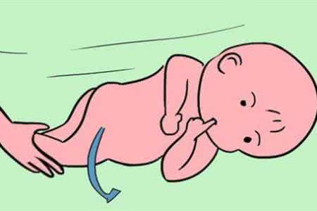 佝偻病病因 新生儿佝偻病的病因 5种病因你都知道吗