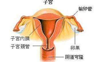 卵巢癌的早期症状 卵巢癌的症状 警惕4大卵巢“杀手”
