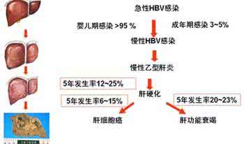 乙型肝炎肝硬化 主治:乙型肝炎,慢性肝炎,肝硬化