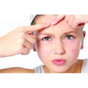 痘痘肌肤如何护理 痘痘肌肤如何护理 祛痘最好的方法是什么?如何护理痘痘肌