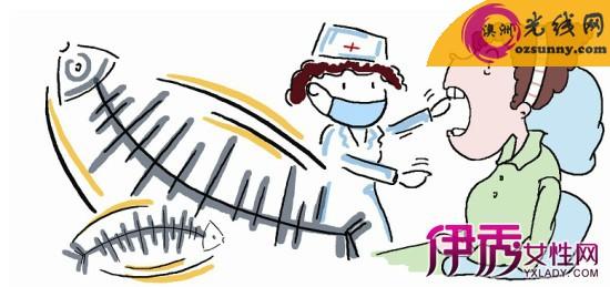 被鱼刺卡到喉咙怎么办 鱼刺卡到喉怎么办