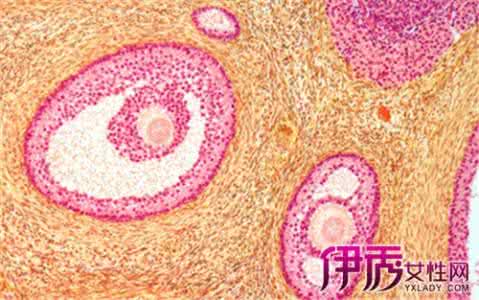 卵泡破裂有什么症状 卵泡破后有什么症状？