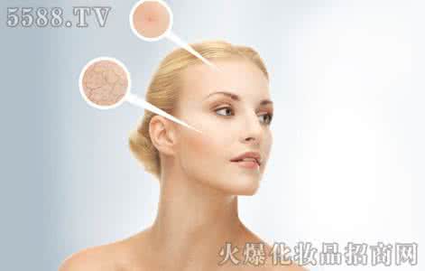 脸上干燥起皮怎么补救 脸上起皮 脸上起皮怎么补救