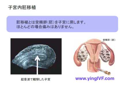 冷冻胚胎移植几天着床 胚胎移植第十三天怎么检测