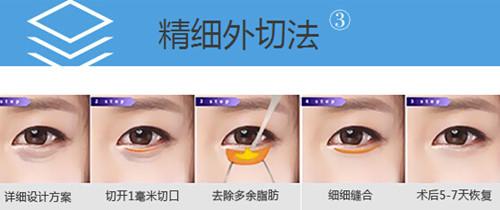 最先进的去眼袋方法 最先进的去眼袋方法 怎么祛眼袋