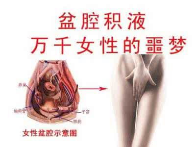 盆腔积液怎么治疗最好 盆腔积液是怎么引起的