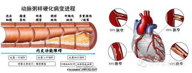 冠心病搭桥和支架 冠心病血管堵塞，不做支架不搭桥的情况下，用中医治疗还能把血管通开吗？(13686073082的回答,...