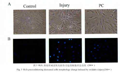 心肌细胞损伤 FGF21对H9C2心肌细胞H/R损伤及Angpt2、GLUT1表达的影响