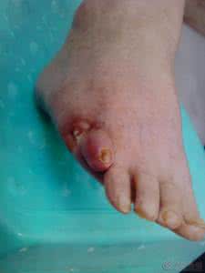 问道伏羲创八卦 问道羲黄 给糖尿病患者的一封信——晨醒山人