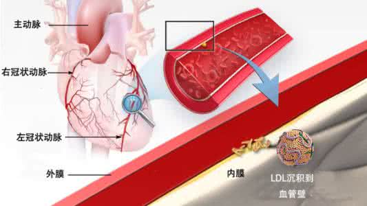 冠心病患者血压低 陆国平：冠心病患者血胆固醇长期管理