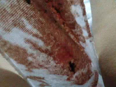 怎么看新生儿发烧 恶露有臭味怎么回事