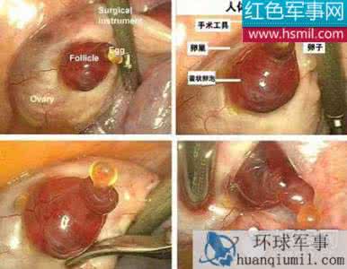 移植后胚胎着床过程图 移植后胚胎着床过程图 胚胎移植后怎样判断是否着床？应该注意哪些问题？