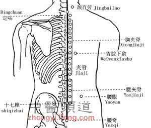 华佗夹脊治百病 华佗夹脊穴验案举隅