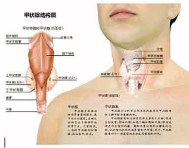 甲状腺癌的原因 甲状腺癌原因 甲状腺癌的致病原因分析