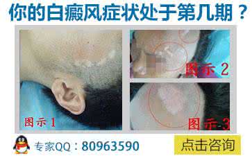 猫咪绝育注意事项 给猫咪洗澡的注意事项 白癜风洗澡的注意事项