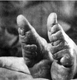 女性的酷刑:揭秘女人缠足全过程