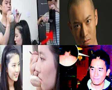 明星脱发怎么治疗的 明星脱发怎么治疗的 明星也躲不了脱发这把杀猪刀……现在终于有办法了！