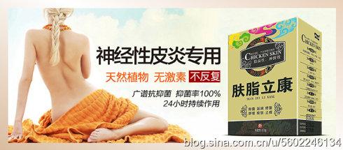 神经性皮炎 疗效 祖传秘方:神经性皮炎疗效百分百活络止痒汤