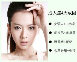 粉刺与青春痘的区别 青春痘与成人痘区别