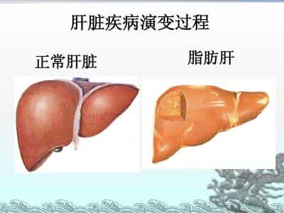 脂肪肝及肝脏硬度检查 脂肪肝及肝脏硬度检查 脂肪肝近在咫尺，如何有效清理肝脏脂肪？