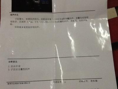 早孕b超检查 怀孕后多久能b超检查 早孕如何检查