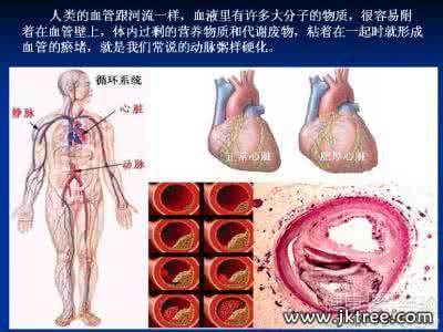 高血压居高不下 高血压的原因 9个因素让血压居高不下