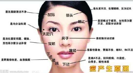 痘痘长的位置代表什么 起痘痘位置代表什么意思