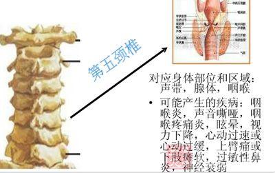 脊椎病的症状 脊椎病的症状 脊椎与全身的疾病图