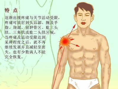 肩周炎缓解疼痛的方法 肩周炎疼痛怎么办 五个方法来缓解