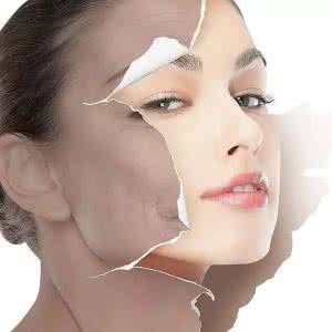 怎样使脸3天快速变白 晒黑了怎么美白