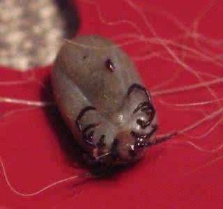 夺命千年虫 夏季千万要小心这种夺命虫上身