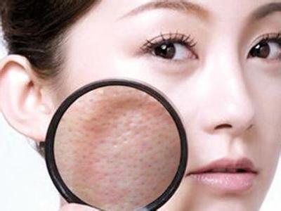 怎么收紧毛孔 收紧毛孔 怎么收紧毛孔