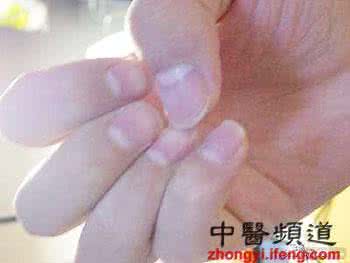 指甲月牙 【健康保健】如何从指甲上的“月牙”来评估自己的身体健康状况