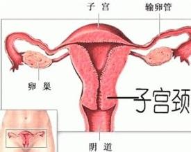 宫颈尖锐湿疣 宫颈尖锐湿疣如何治疗