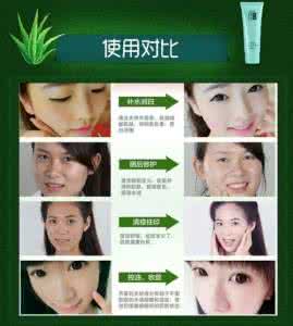 芦荟胶祛痘 芦荟胶祛痘效果好吗 芦荟祛痘效果如何?真的可以美容吗?