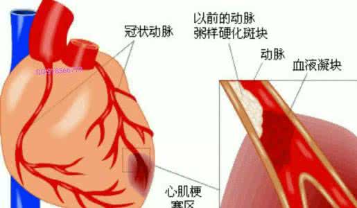 心脏神经症 心脏神经症 心脏神经症?是哪根“神经”出了问题?