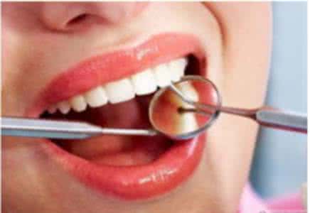 经常洗牙齿有什么危害 洗牙对牙齿有什么好处