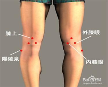 膝盖骨痛 中医擂台76：膝盖骨痛
