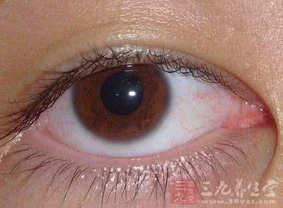 眼球玻璃体混浊 眼球玻璃体混浊 眼球玻璃体混浊 玻璃体混浊的原因是什么