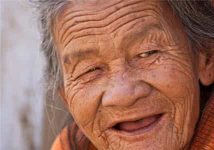 最简单除老年斑的偏方 去掉老年斑偏方 去掉老年斑的偏方