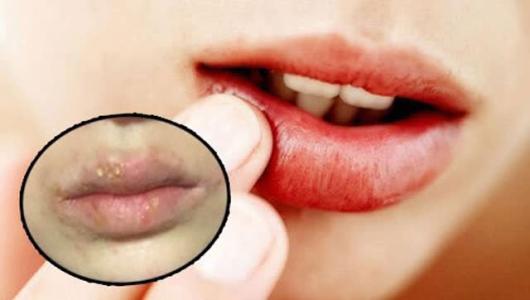 撕嘴唇皮 撕嘴唇皮的后果 必须提醒你！冬天嘴唇再做这件事，后果相当严重！