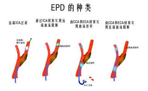 2015春节香港好去处 防患于未然 冠心病患者防患于未然过好春节