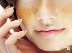 孩子皮肤发黄 孩子皮肤发黄 孕妇吃橘子，生的孩子皮肤会发黄