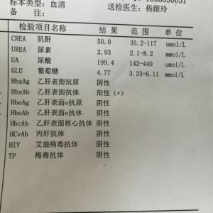 乙肝表面抗原抗体阳性 乙肝表面抗体阳性 乙肝抗体阳性 它的存在意义及饮食注意事项